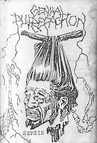 Genital Putrefaction : Sepsis